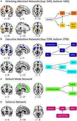 Attention, attention! Posttraumatic stress disorder is associated with altered attention-related brain function